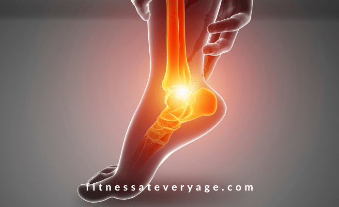 How I Cured My Plantar Fasciitis in Less Than 6 Months